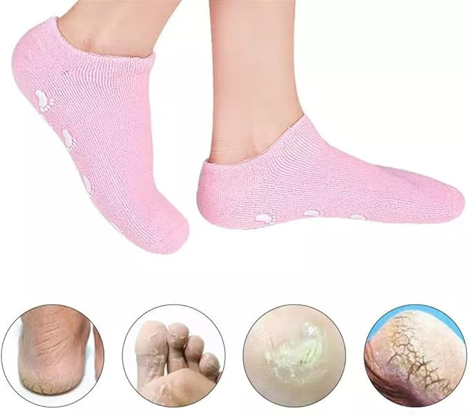 2pcs Moisturizing Socks – Heel Protection & Crack Repair Gel Socks