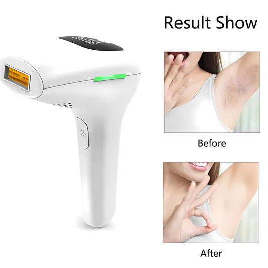 IPL Hair Removal System – Permanent Laser Hair Reduction for Women & Men