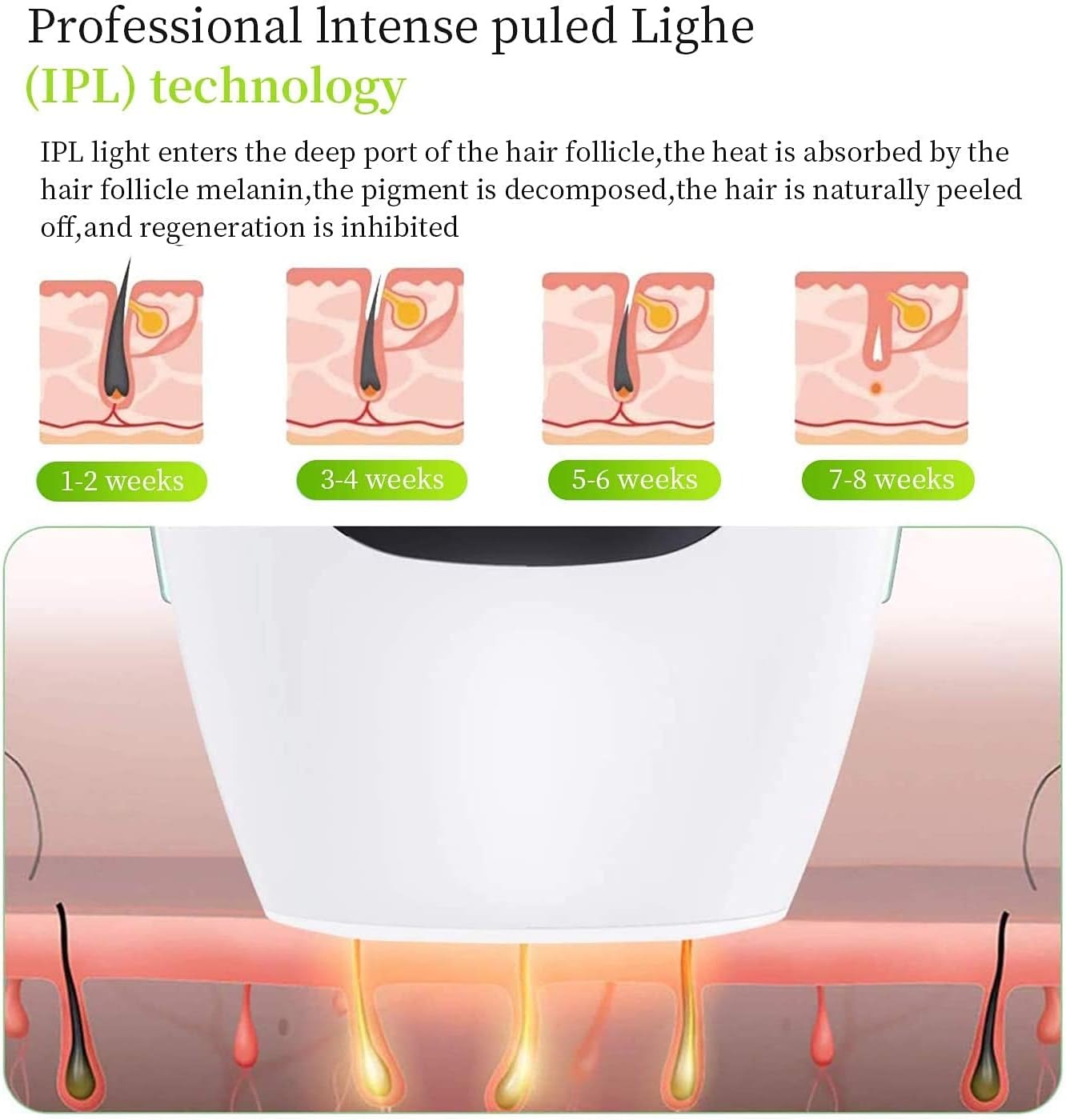 IPL Hair Removal System – Permanent Laser Hair Reduction for Women & Men