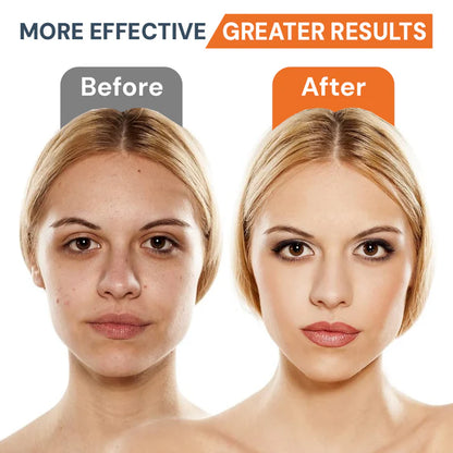 Rechargeable LED Facial & Neck Massager | Double Chin Remover & Skin Tightening Device